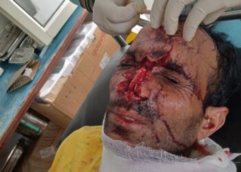 दो व्यक्तियों पर भालुओं का हमला,  चौपाल क्षेत्र में दहशत