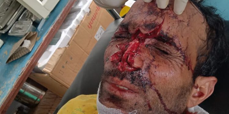 दो व्यक्तियों पर भालुओं का हमला,  चौपाल क्षेत्र में दहशत