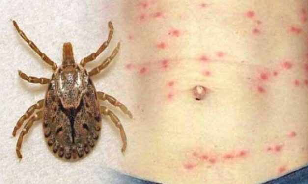 हिमाचल में कोरोना के बीच  स्क्रब टायफस के मामले, अब तक 648…