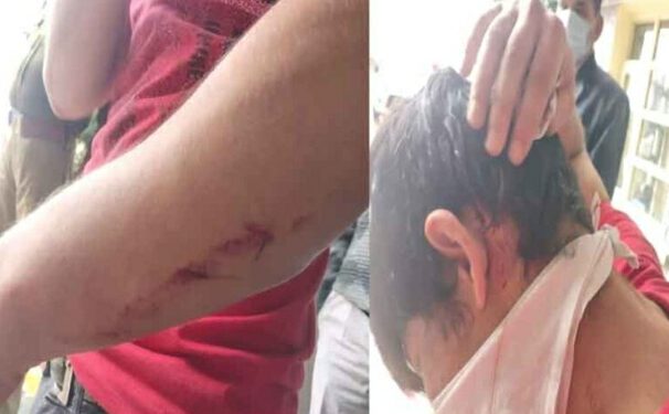 छात्र संगठनों में खूनी झड़प