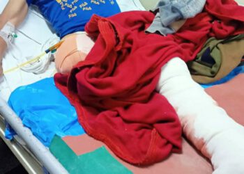 बेसहारा, जख्मी नेपाली मज़दूर के लिए ठियोग के दो युवक बने मसीहा