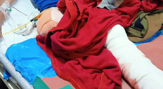 बेसहारा, जख्मी नेपाली मज़दूर के लिए ठियोग के दो युवक बने मसीहा