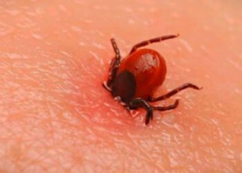 IGMC में स्क्रब टायफस से 1 व्यक्ति की मौत 1 से 2 मामले आ रहे प्रतिदिन अबतक 320 पॉजटिव ,6 की मौत